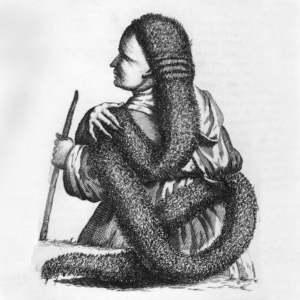 Колтун (plica polonica), иллюстрация из книги Томаса Салмона, изданной в Венеции, 1739 г., источник: Wikimedia