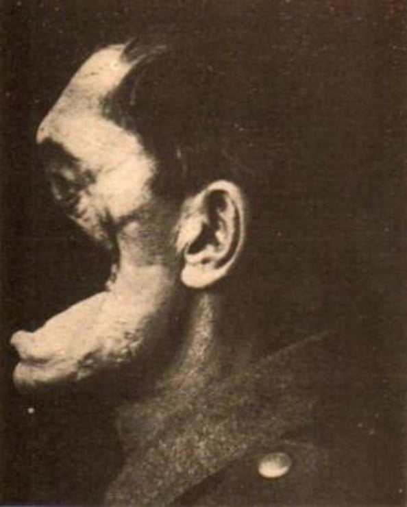 «Krieg dem Kriege! Guerre à la Guerre! War against War! Oorlog aan den Oorlog! Ernst Friedrich», 1924. Фото: arbeiterfotografie.com